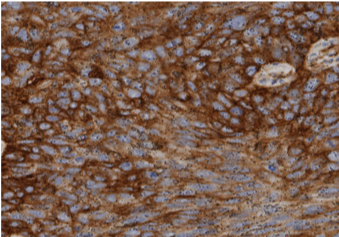 Histopathology Image (Digitalized PD-L1Slide, In-House Data)